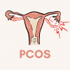 pcos fhk